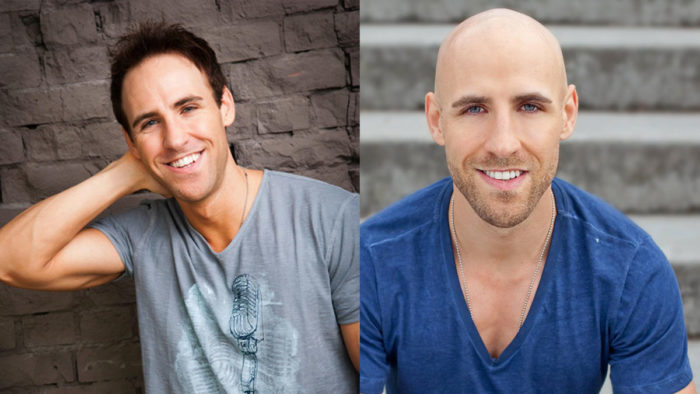 my hair loss story